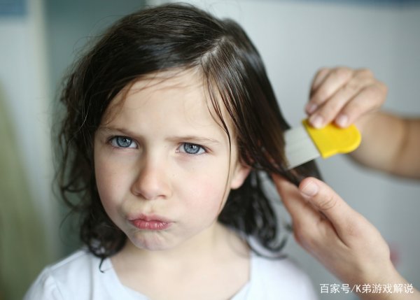 头上有虱子怎么办,头上长虱子怎么办怎样简便消除图3