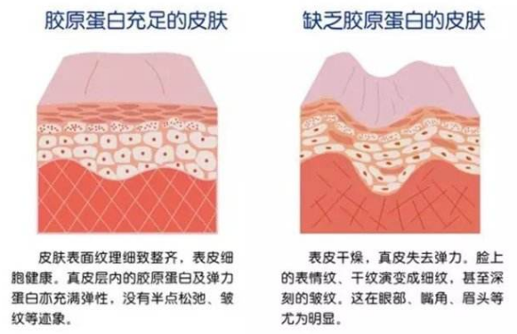 含有胶原蛋白的食物有哪些,什么食物中含有丰富的胶原蛋白图1