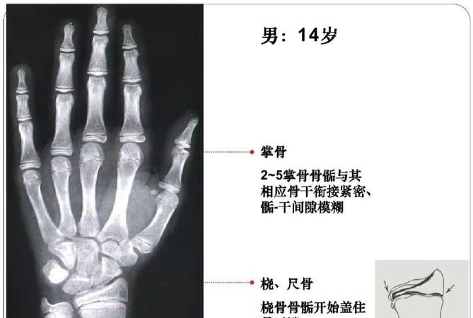 4岁骨龄每年能长几cm,青春期发育:孩子几岁算是青春期了图2