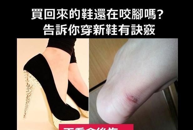 鞋子磨脚后跟怎么办,鞋子磨脚后跟怎么处理就不磨脚了