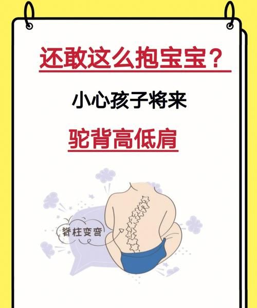 宝宝驼背矫正最佳时间,孩子体态不好看什么科图8