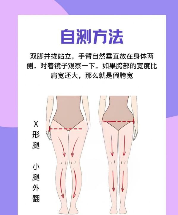 假胯宽矫正需要多久,矫正假胯宽图2