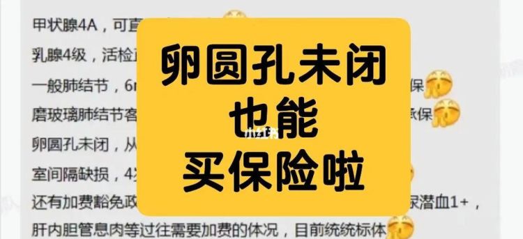 卵圆孔未闭可以买保险,卵圆孔未闭能买保险图1