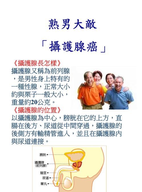 摄护腺癌有什么症状,8成摄护腺癌都可以在转移前发现4种治疗方式应该这样选图3