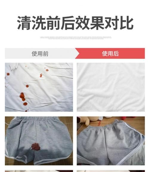 衣服上的血渍如何清洗干净,衣服上的血迹用什么能洗掉图7