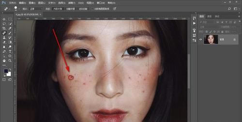 ps如何消除大片斑点,ps怎么去脸上的斑点图3