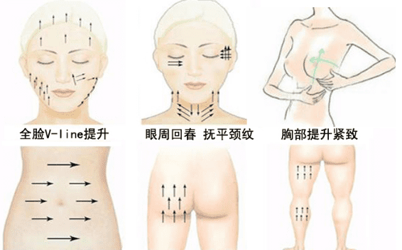 再生面雕是什么,面雕带的怎么样图7