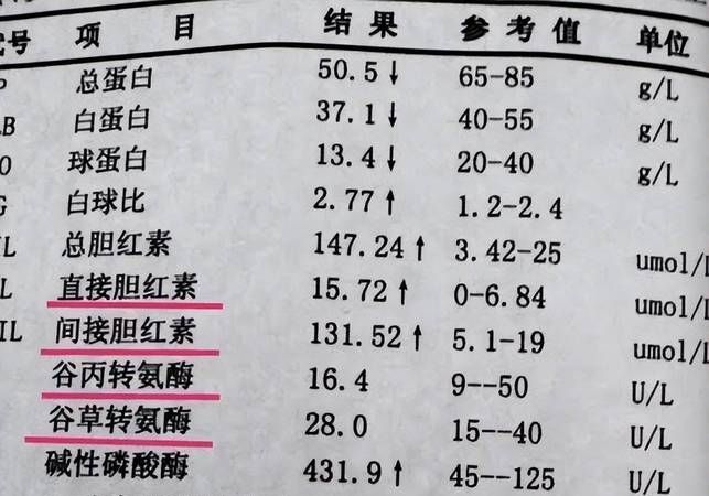 谷丙转氨酶怎么升高,谷丙转氨酶高是怎么回事图1