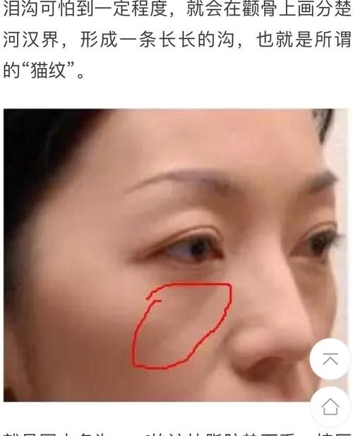 印第安纹怎么去除,您好您拨打的电话正在通话中请稍后再拨图1