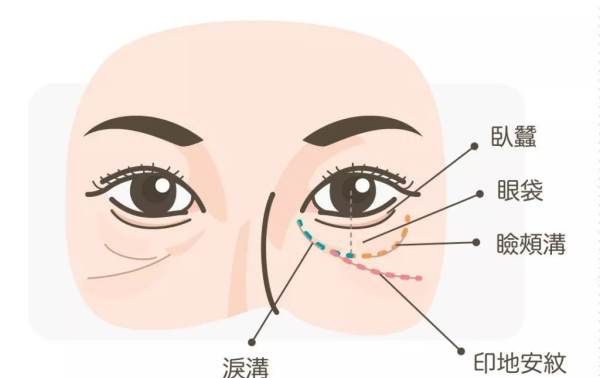 印第安纹怎么去除,您好您拨打的电话正在通话中请稍后再拨图4