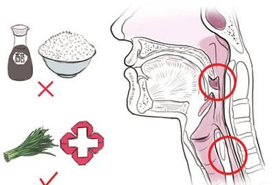 卡在喉咙里的鱼刺怎么去除,小鱼刺卡在喉咙怎么办最有效的办法图1