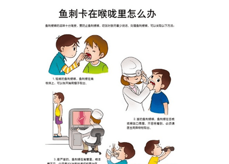 卡在喉咙里的鱼刺怎么去除,小鱼刺卡在喉咙怎么办最有效的办法图8