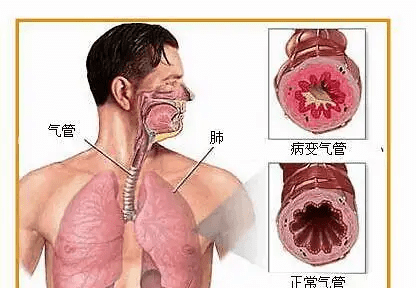 相邻权受损的特征有哪些,简述相邻关系的概念和特征图1