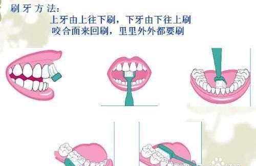 如何爱护牙齿方法,如何保护牙齿图15