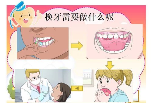 如何爱护牙齿方法,如何保护牙齿图20