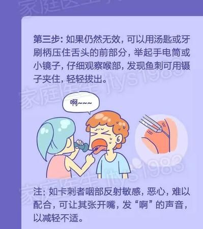 喉咙有细鱼刺怎么去除,鱼刺卡喉咙里有什么办法图2