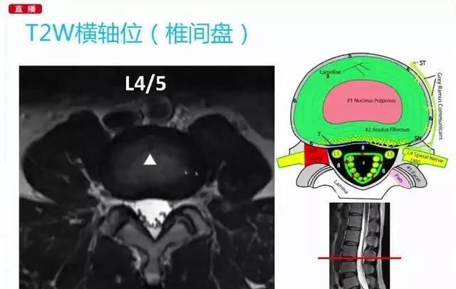 如何看懂磁共振片子,mri检查报告单如何看图2