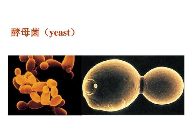 酵母菌是原核生物,原核生物a酵母菌b木耳c葡萄球菌d灵芝菌