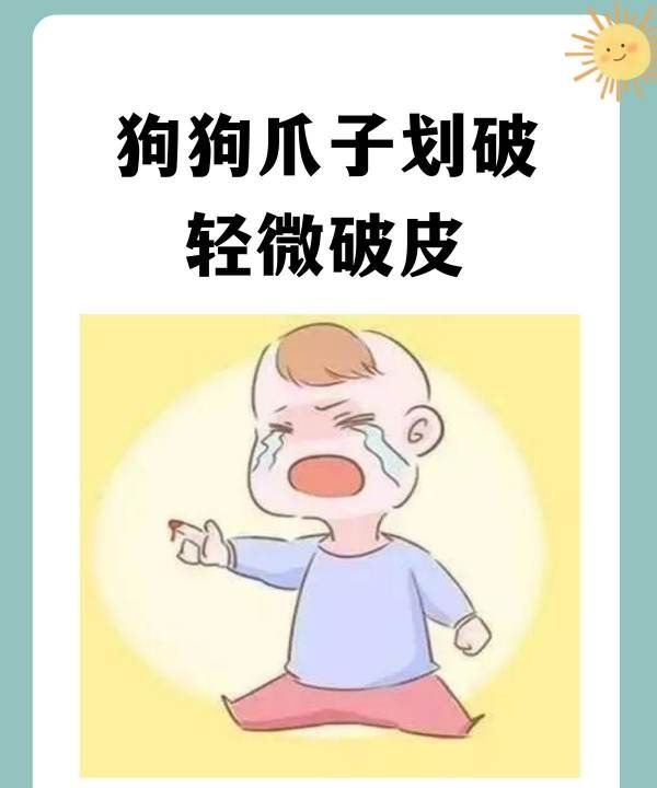 被狗狗抓伤怎么办,狗狗爪子划破轻微破皮要打疫苗图1