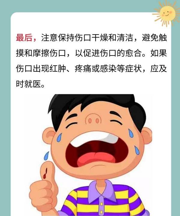 被狗狗抓伤怎么办,狗狗爪子划破轻微破皮要打疫苗图4